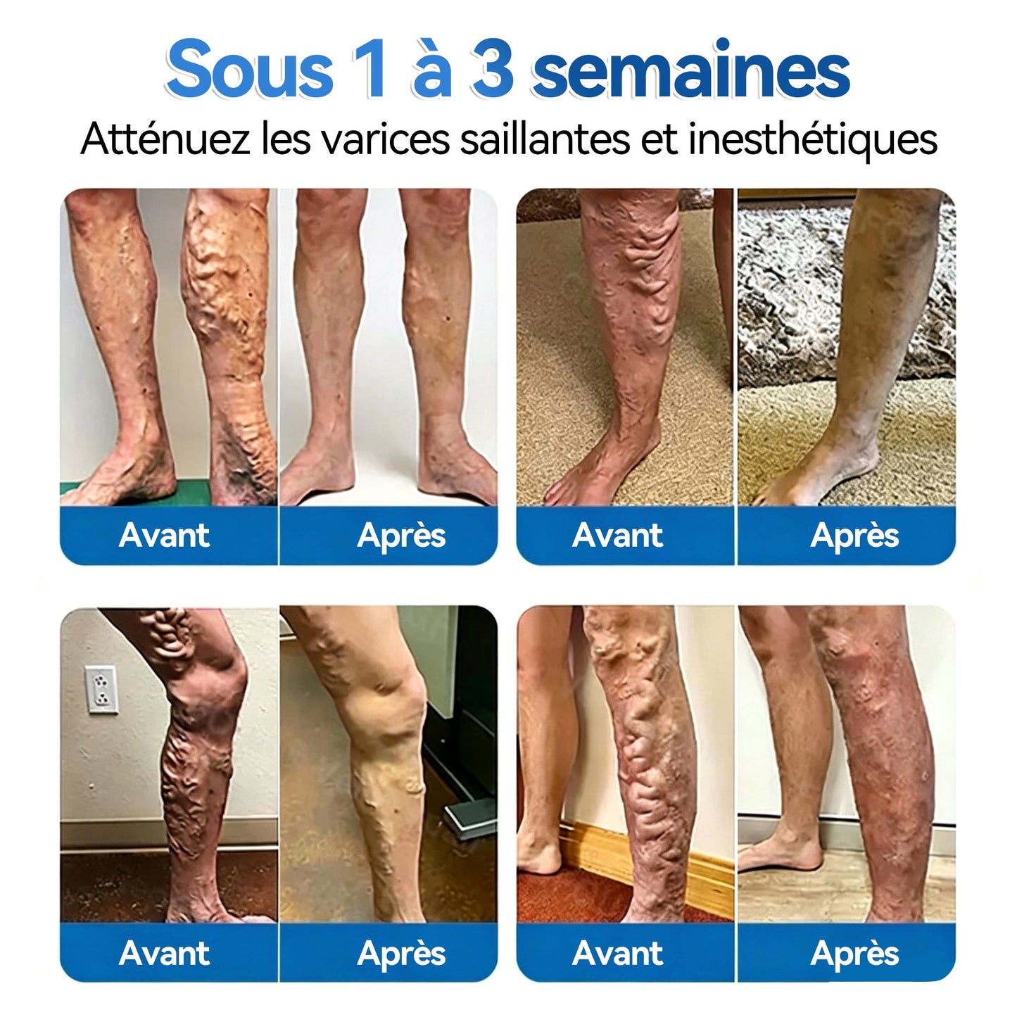 🍁💖𝐅𝐥𝐨𝐫𝐢𝐬𝐦𝐚®𝐑é𝐩𝐚𝐫𝐚𝐭𝐢𝐨𝐧 𝐃𝐞𝐬 𝐕𝐞𝐢𝐧𝐞𝐬 𝐑𝐨𝐮𝐥𝐞𝐚𝐮 𝐃𝐞 𝐏𝐚𝐭𝐜𝐡𝐬 𝐀𝐯𝐞𝐜 𝐌𝐢𝐜𝐫𝐨-𝐚𝐢𝐠𝐮𝐢𝐥𝐥𝐞𝐬⚡Soulagement immédiat, résultats à long terme