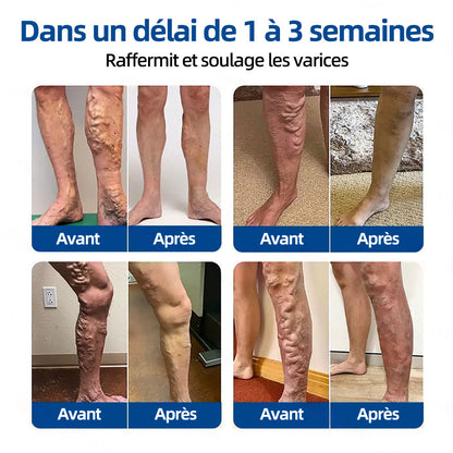 ✅𝐅𝐥𝐨𝐫𝐢𝐬𝐦𝐚® 🌼💖𝐂𝐢𝐛𝐥𝐞 𝐕𝐞𝐢𝐧𝐞𝐮𝐬𝐞 𝐏𝐚𝐭𝐜𝐡 À 𝐌𝐢𝐜𝐫𝐨-𝐀𝐢𝐠𝐮𝐢𝐥𝐥𝐞𝐬⚡Soulagement immédiat, résultats durables