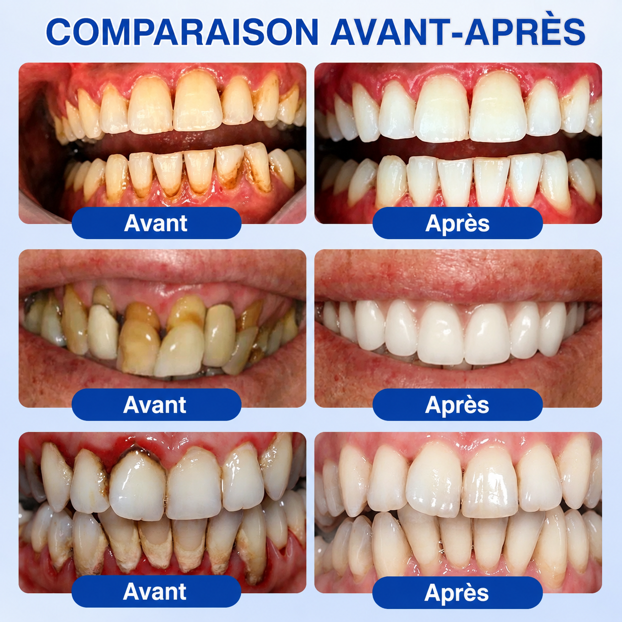 🍁💖 𝑮𝒍𝒊𝒎𝒎𝒆𝒓𝒍𝒚®🦷 𝑮𝒖𝒎𝑹𝒆𝒗𝒊𝒗𝒆 𝑮𝒆𝒍 𝒅𝒆 𝑹é𝒑𝒂𝒓𝒂𝒕𝒊𝒐𝒏 𝑷𝒂𝒓𝒐𝒅𝒐𝒏𝒕𝒂𝒍𝒆