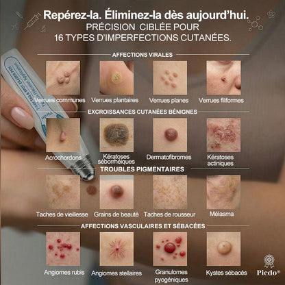 Boutique officielle de la marque 𝐏i𝐜𝐝o® 💐💖7 Jours Effaceur de taches et d’excroissances cutanées(Zéro douleur, zéro cicatrice – Roller)