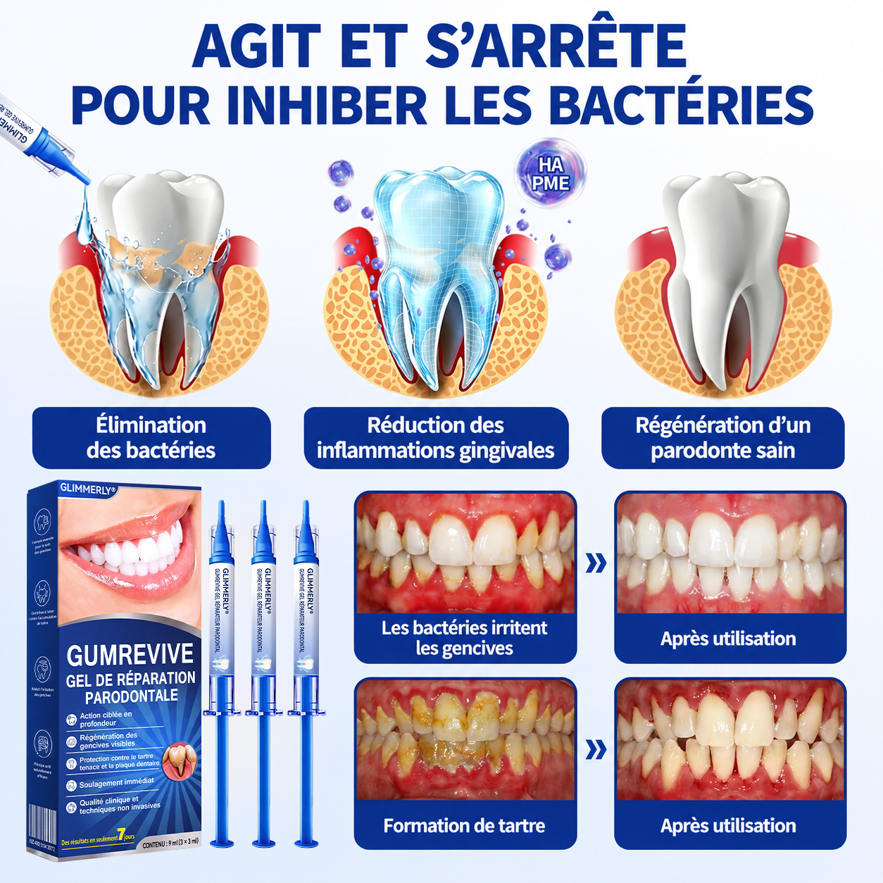 🍁💖 𝑮𝒍𝒊𝒎𝒎𝒆𝒓𝒍𝒚®🦷 𝑮𝒖𝒎𝑹𝒆𝒗𝒊𝒗𝒆 𝑮𝒆𝒍 𝒅𝒆 𝑹é𝒑𝒂𝒓𝒂𝒕𝒊𝒐𝒏 𝑷𝒂𝒓𝒐𝒅𝒐𝒏𝒕𝒂𝒍𝒆