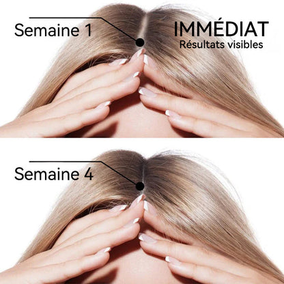 🌿👨‍⚕️ Boutique officielle française | 🔥𝐓𝐨𝐜𝐥𝐯𝐨®🍁💖𝐁𝐢𝐨𝐭𝐢𝐧𝐞 𝐑𝐨𝐦𝐚𝐫𝐢𝐧 𝐇𝐚𝐮𝐭𝐞𝐦𝐞𝐧𝐭 𝐄𝐟𝐟𝐢𝐜𝐚𝐜𝐞 𝐒é𝐫𝐮𝐦 𝐏𝐨𝐮𝐫 𝐋𝐚 𝐏𝐨𝐮𝐬𝐬𝐞 𝐃𝐞𝐬 𝐂𝐡𝐞𝐯𝐞𝐮𝐱 — (🔥 Offre à durée limitée, ⏳ Promotion du dernier jour : 50 % de réduction)